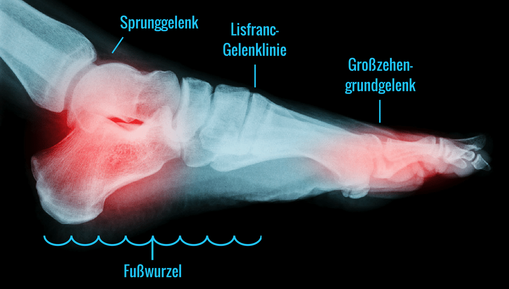 Anatomie des Fußes: Sprunggelenk, Fußwurzel, Großzehengrundgelenk